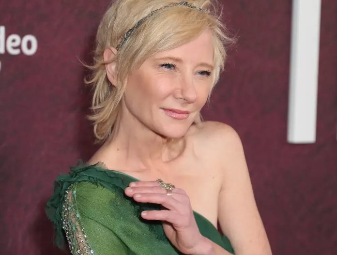 Atriz Anne Heche está em estado 